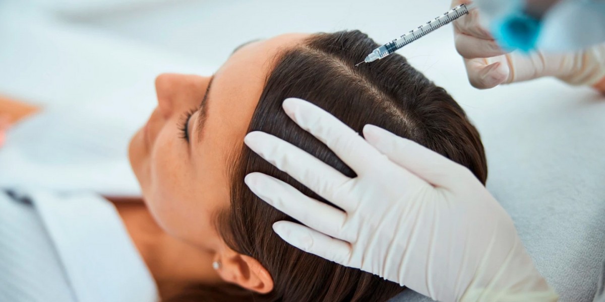 Benefits of Combining PRP with Microneedling for Hair Growth