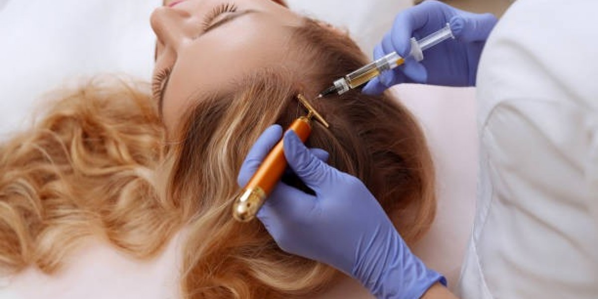PRP Hair Treatment for Hair Thinning: What Makes It Effective
