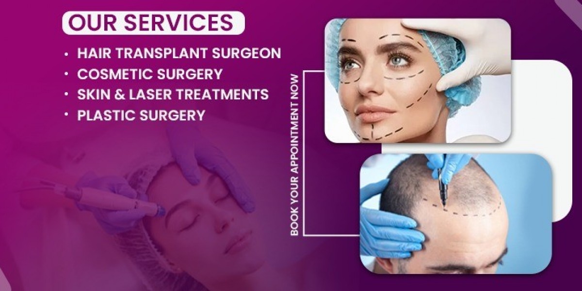 Best Hair Transplant in NCR – Achieve Natural, Long-Lasting Hair Restoration