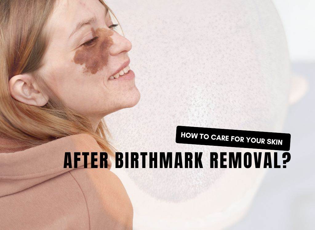 How to Care for Your Skin After Birthmark Removal - Birthmark Removal in Kolkata