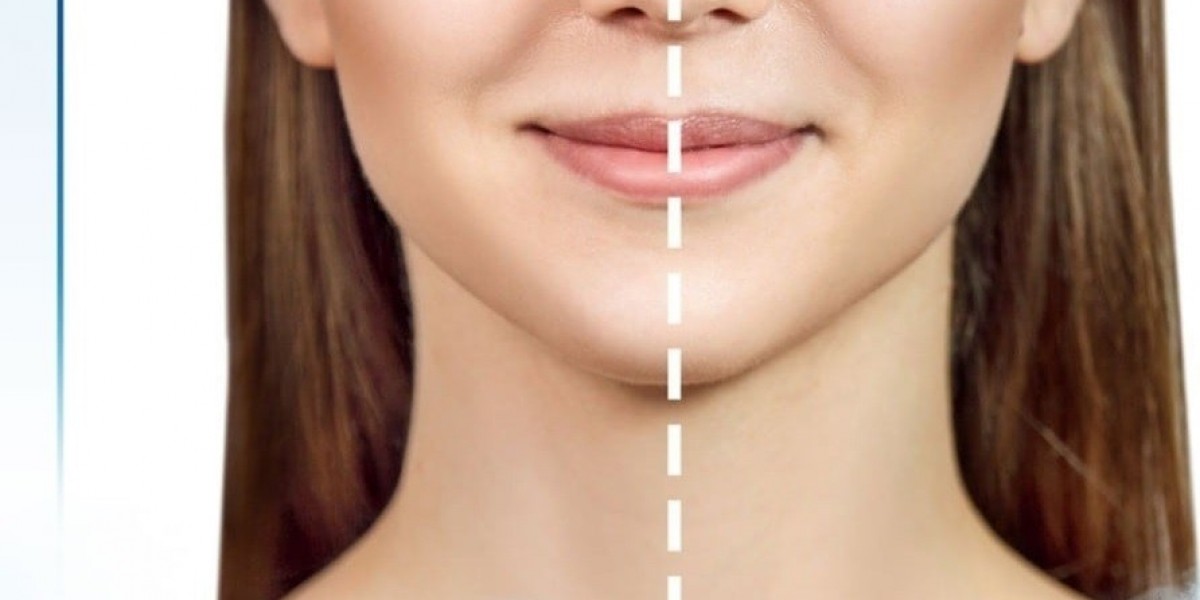 Dubai Whitening Therapy: Glutathione Safety Rules