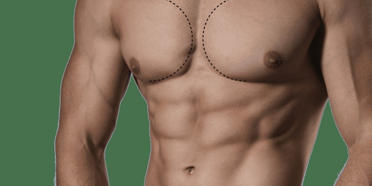 Key Benefits of Gynecomastia Surgery