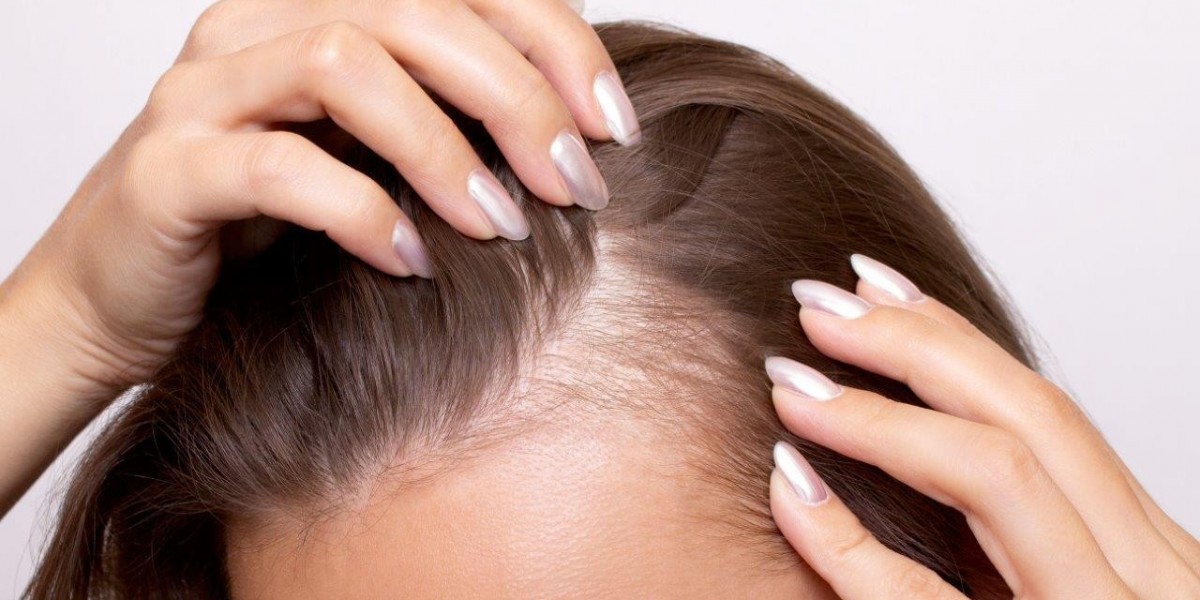 Redefining Hair Restoration: The Power of Technology, Precision, and Patient Experience