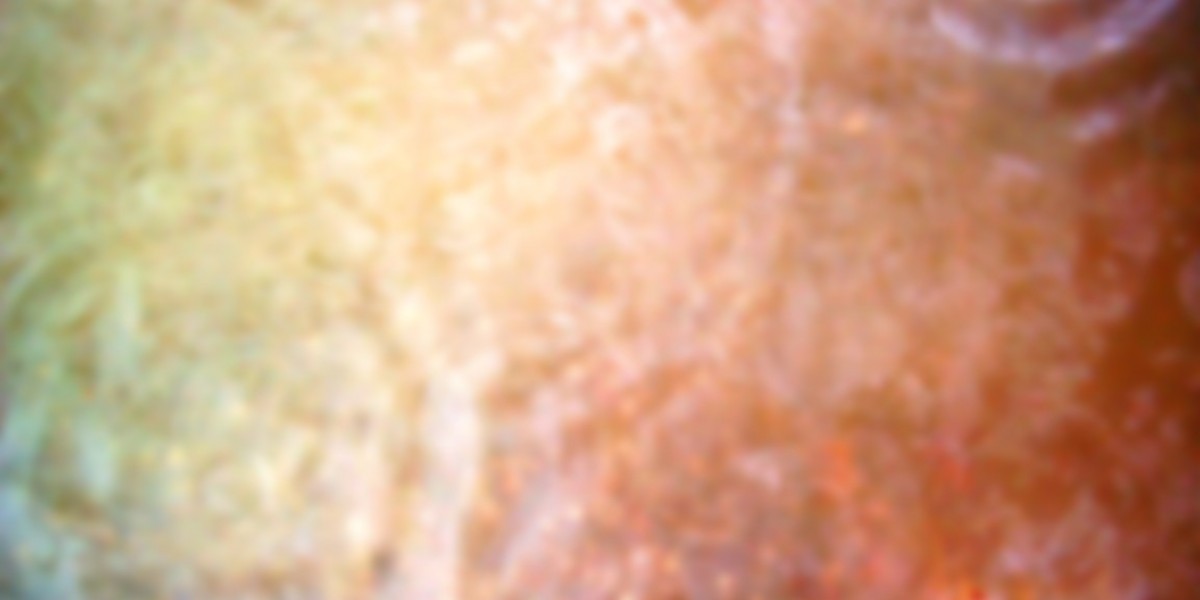 Sydneys spin-off of The Palomar at the 25hours Hotel The Olympia is a hotel restaurant powered by an open kitchen and fi