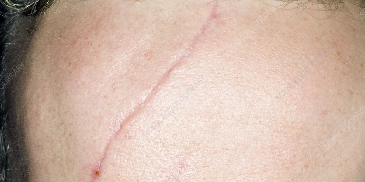 Dubai Plastic Surgeons Specializing in Facial Scars