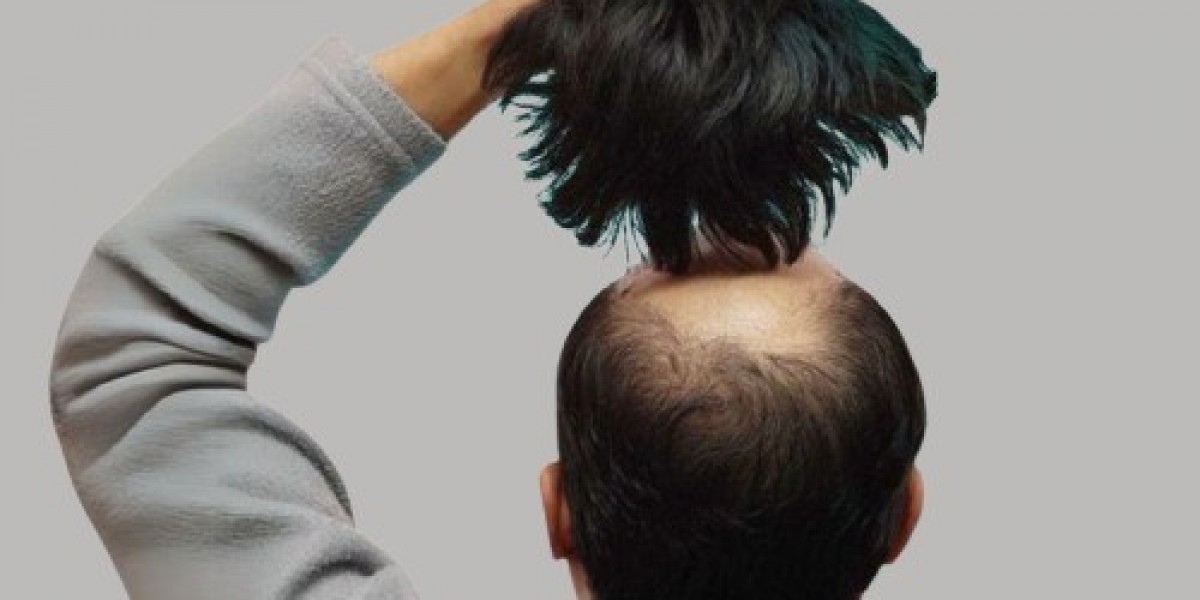 Premium Quality Hair Wigs in Islamabad for Parties