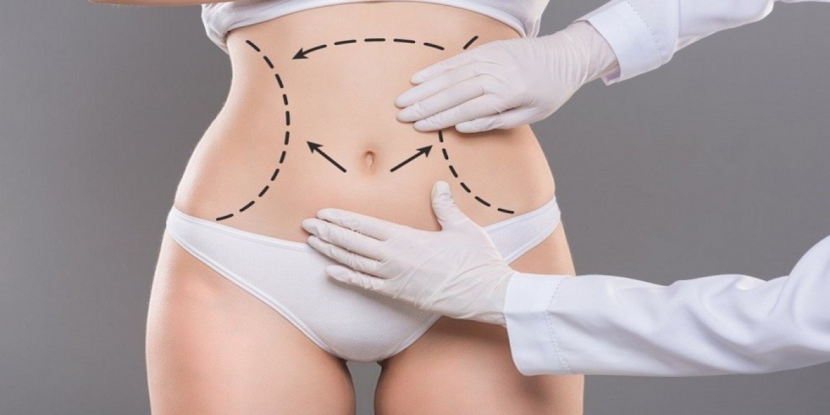 كيف تختار أفضل عيادة لشفط الدهون في الرياض؟