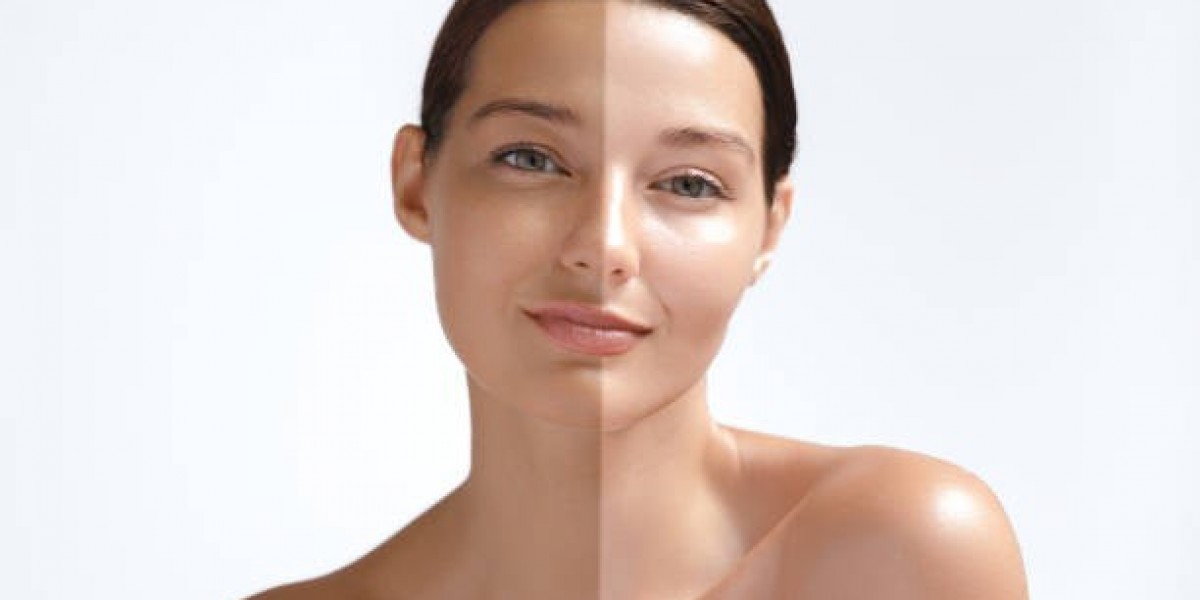 Skin Whitening Dubai: Latest Methods & Treatments