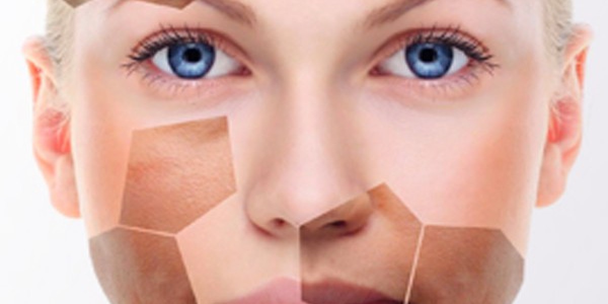 Skin Whitening Treatment Dubai: Smart Glow Methods