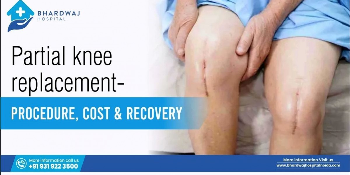 Partial Knee Replacement – Expert Orthopedic Care at Bhardwaj Hospitals Noida