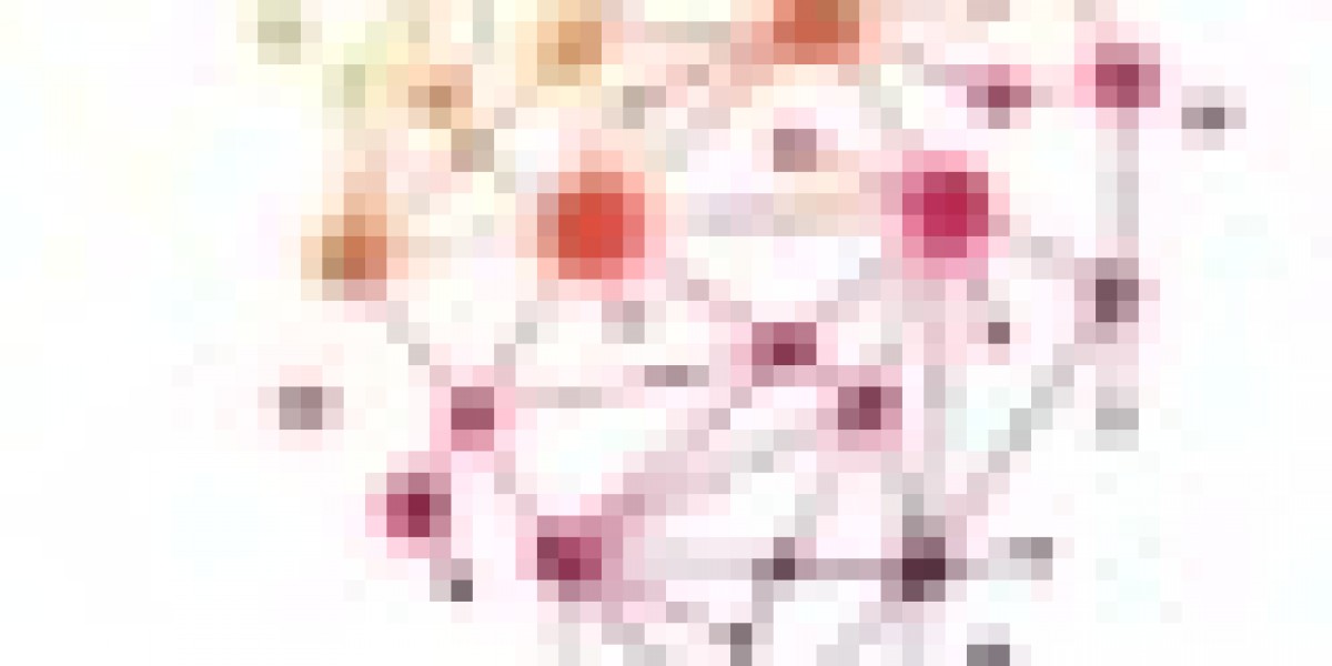 Comparing Microsoft Consultants vs In-House Teams for Cloud Projects