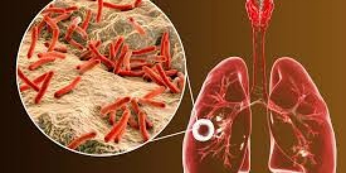 TB Diagnostics Market Analysis 2026–2034: Value Chain, Pricing Dynamics, and Key Demand Drivers
