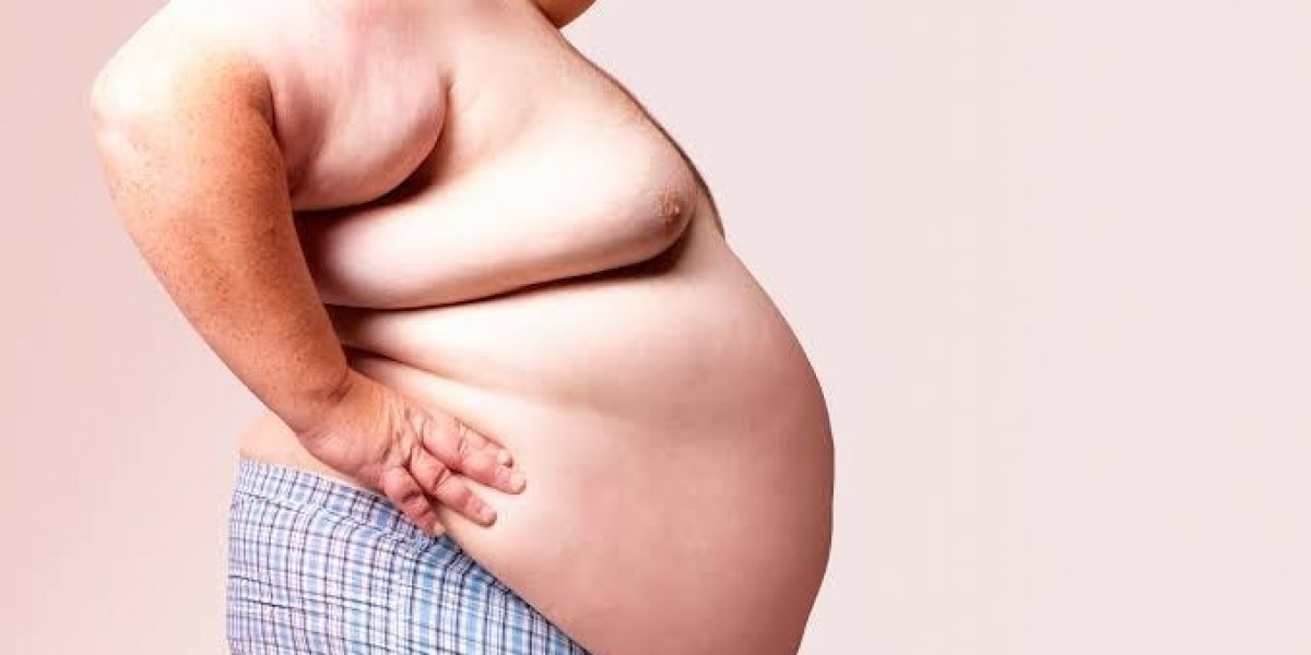Lifestyle Changes Recommended in Obesity Treatment Dubai