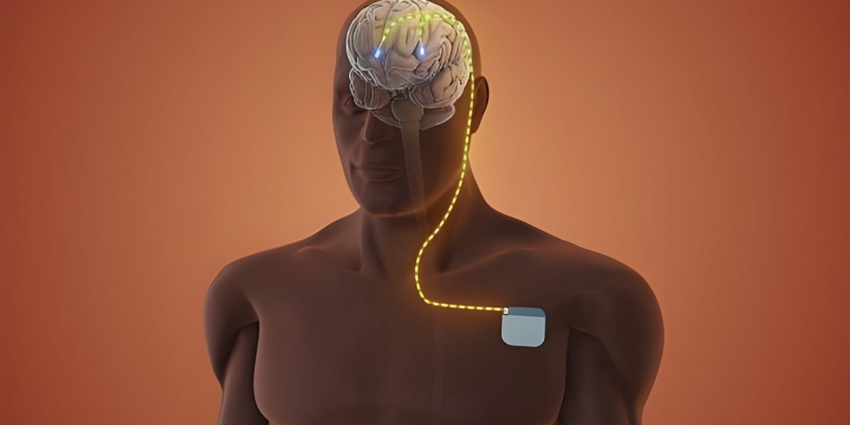 Transforming Modern Medicine with Advanced Neuromodulation Technologies
