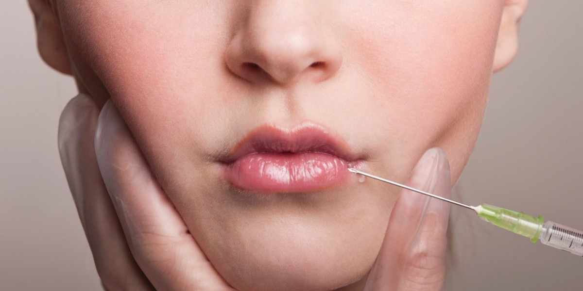 Lip Fillers Injections Define Structure While Enhancing Personality