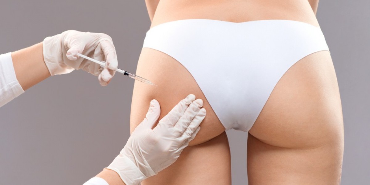 Butt Fillers in Dubai for Non-Surgical Shape Enhancement