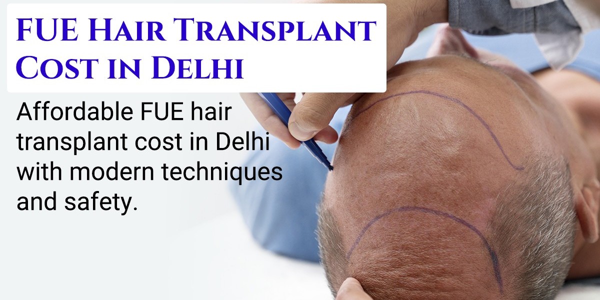 7 Life-Changing Benefits of FUE Hair Transplant