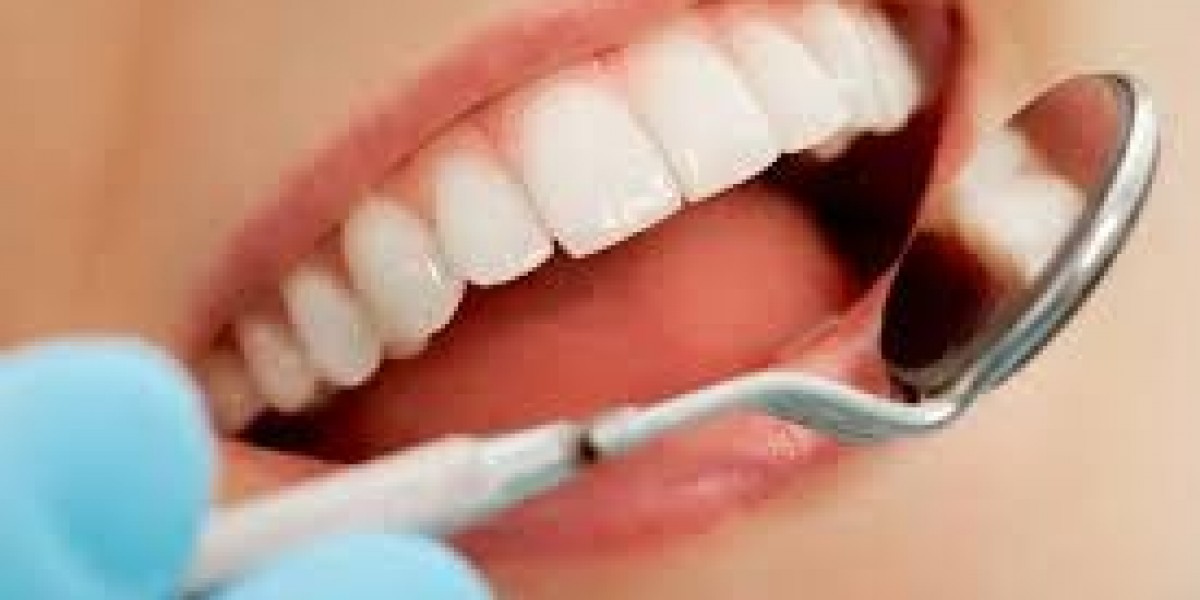 How All-on-4 Dental Implants Assist Patients in Restoring Function and Smile Confidence