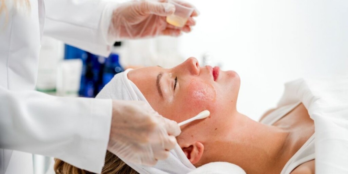 Can Chemical Peels in Islamabad Tighten the Skin?