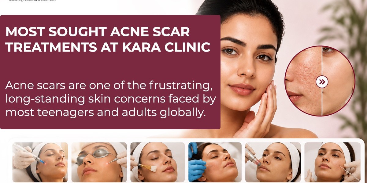 Why Acne Keeps Coming Back — And What You Can Actually Do About It