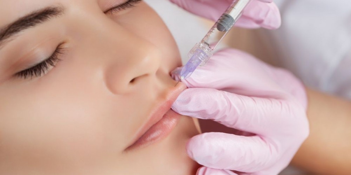 Radiesse Fillers in Dubai: Why Patients Recommend Our Clinic