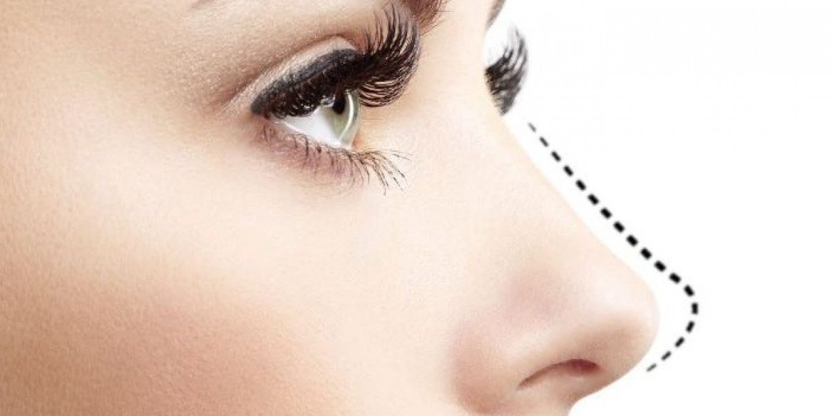 Rhinoplasty Surgery in Dubai for Personalized Results