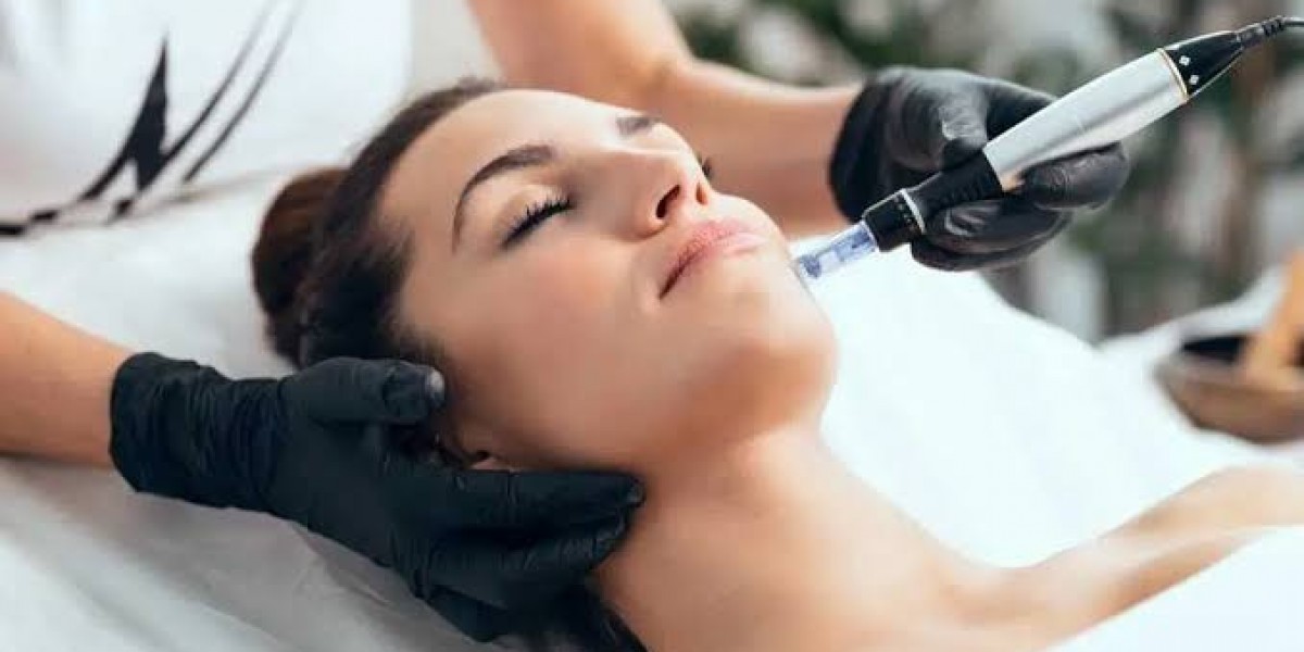 Microneedling Treatment for Healthy, Glowing Skin Today