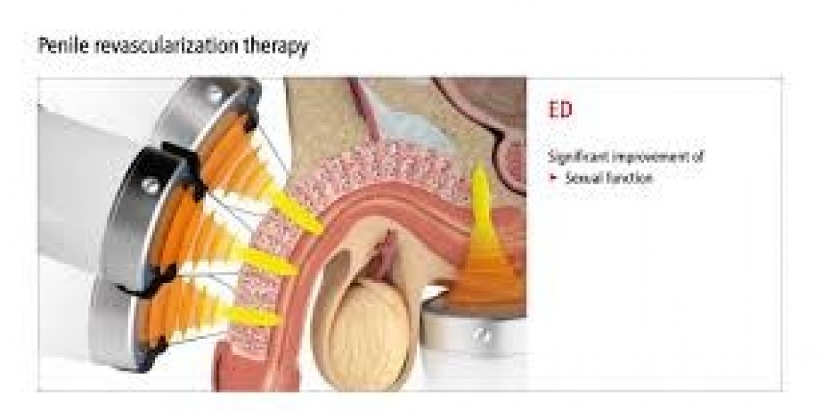 Common Causes of Erectile Dysfunction and Available Treatments in Dubai | Complete Guide