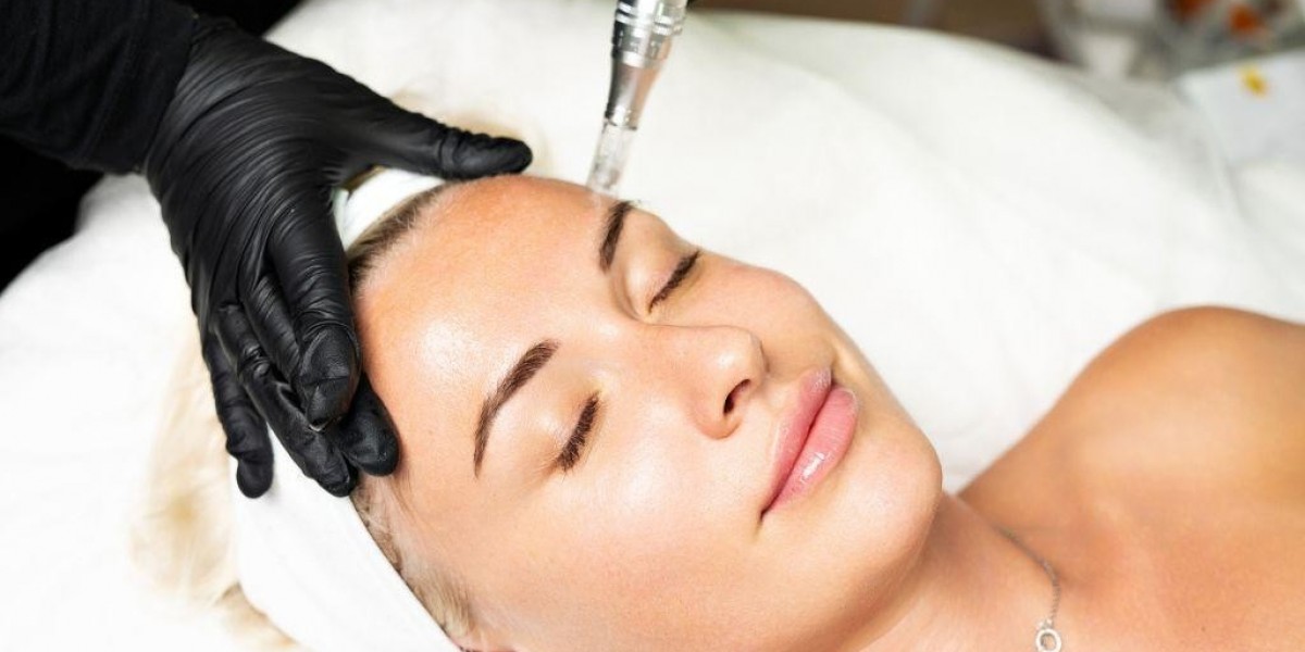 Microneedling with PRP in Dubai for Fine Lines