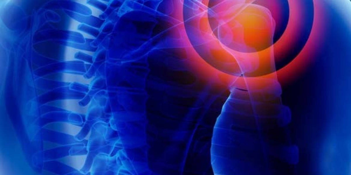 Choosing the Best Orthopedic Surgeons in Queens for Comprehensive