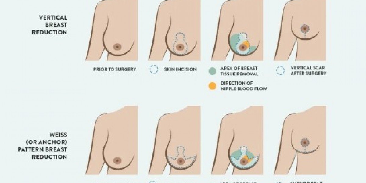 Quality nipple discharge treatment in pune by Dr Shilpy