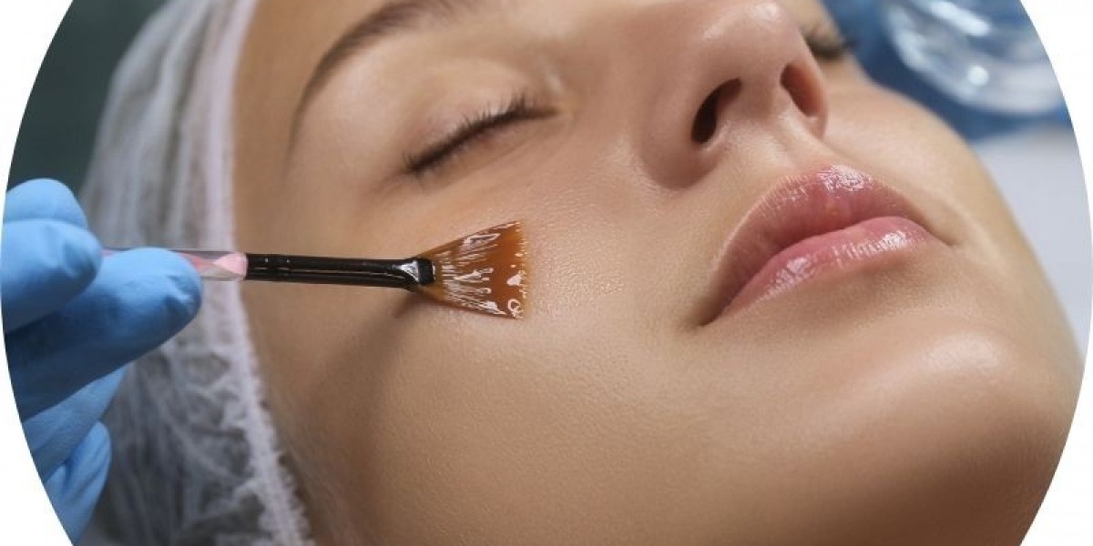 Stretch Mark Removal Treatment: Laser Treatment For Stretch Marks Cost – Complete Guide to Smoother Skin