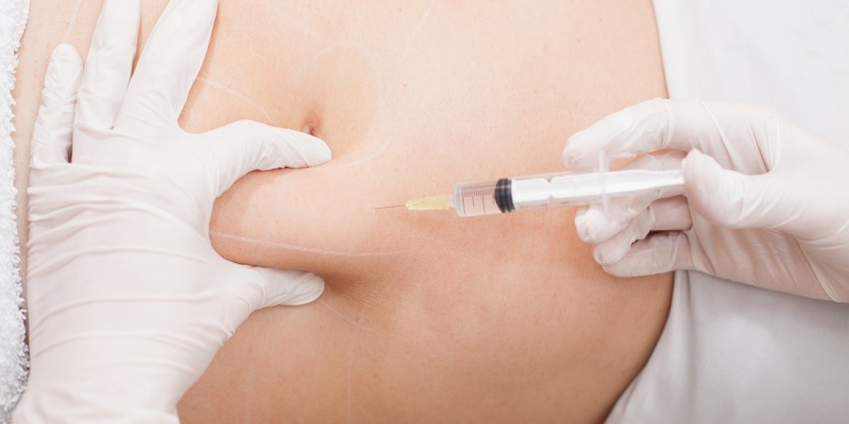 Top Clinics for Safe Fat Melting Injections in Dubai