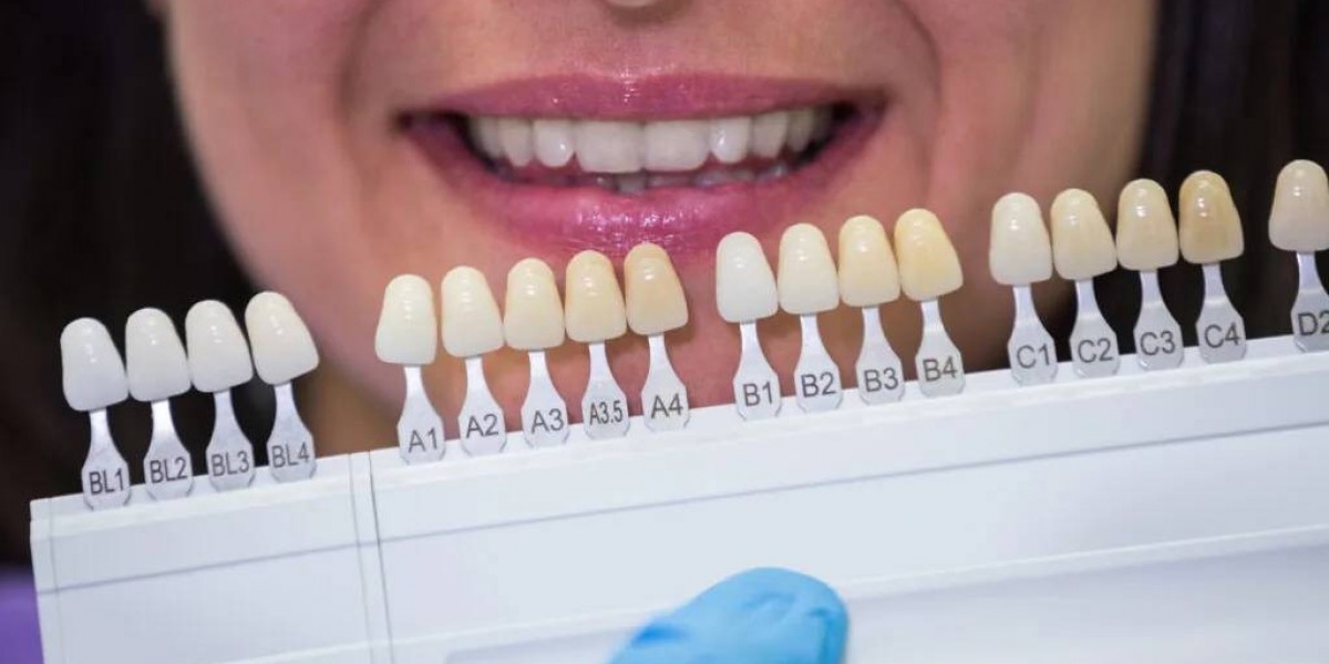 When Should Old Amalgam Fillings Be Replaced