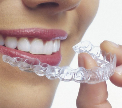 Invisible Aligners in Jaipur | Dental Seva – Smile Confidently