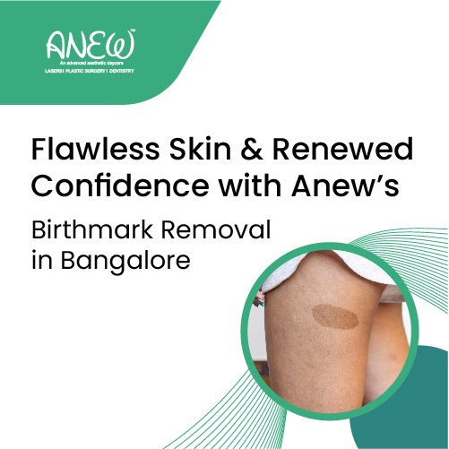 Laser Birthmark Removal | Advanced Treatment for Birthmarks