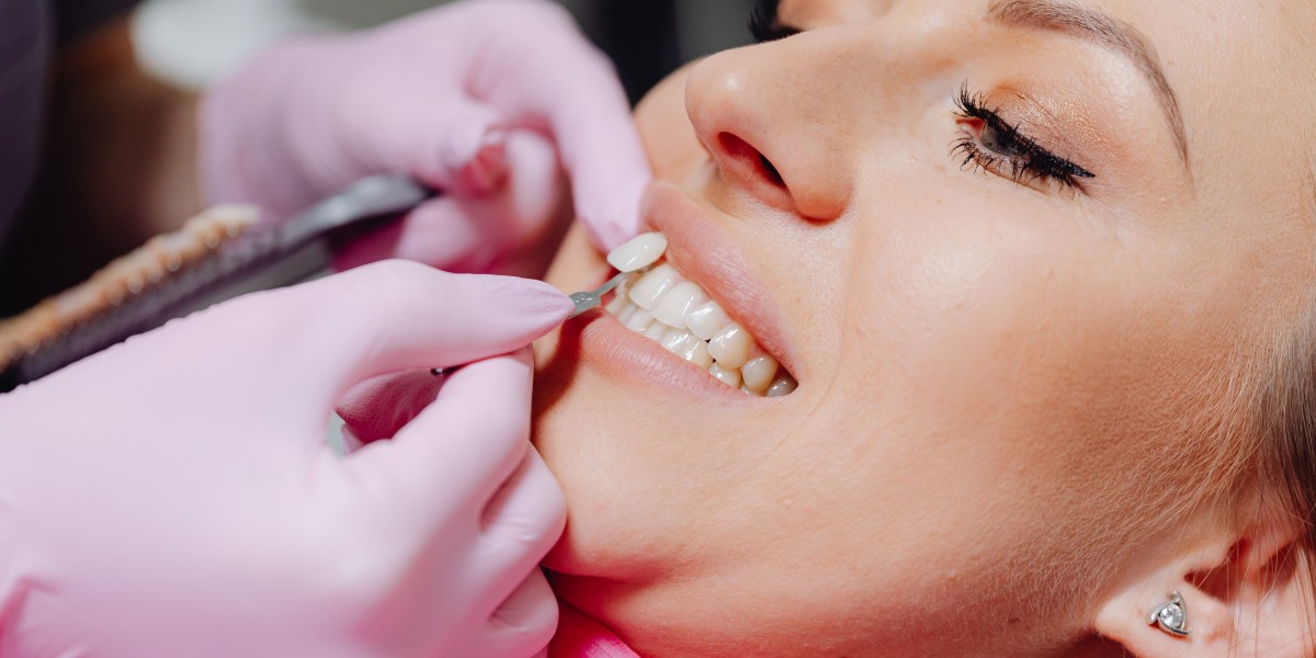Why Won’t My Teeth Whitening Treatment Work? Teeth Whitening Hertfordshire