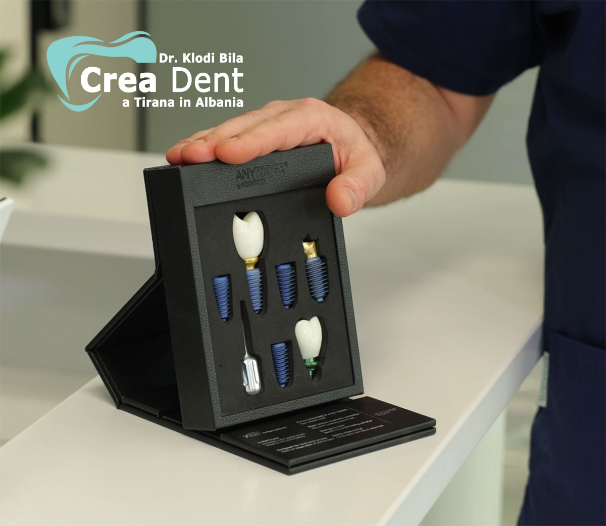 Professor Dr. Klodi Bila Dentisti in Albania con Clinica dentale a Tirana