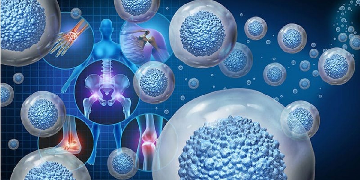 Stem Cell Treatment for Diabetes in UAE and Arthritis Research